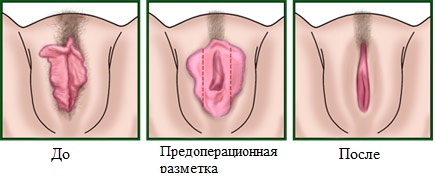 Услуги интимного косметолога в Подольске