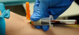 анализ крови из вены